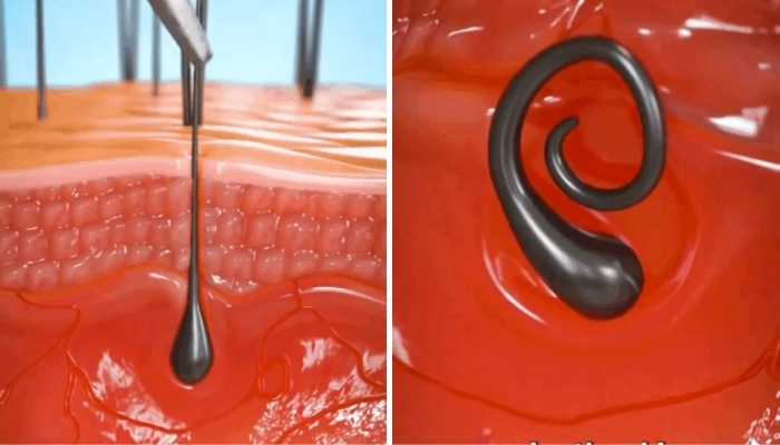 Hair Plucking Simulation Shows Disturbing Effects You Should Know