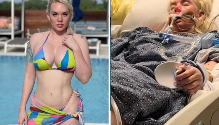 Model’s Leg Amputated After Vacation Trip To The Bahamas
