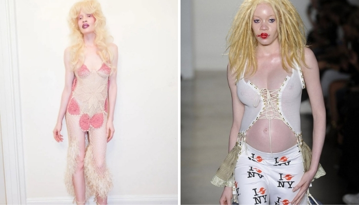 Diandra Forrest, the African-American Albino Catwalk Model